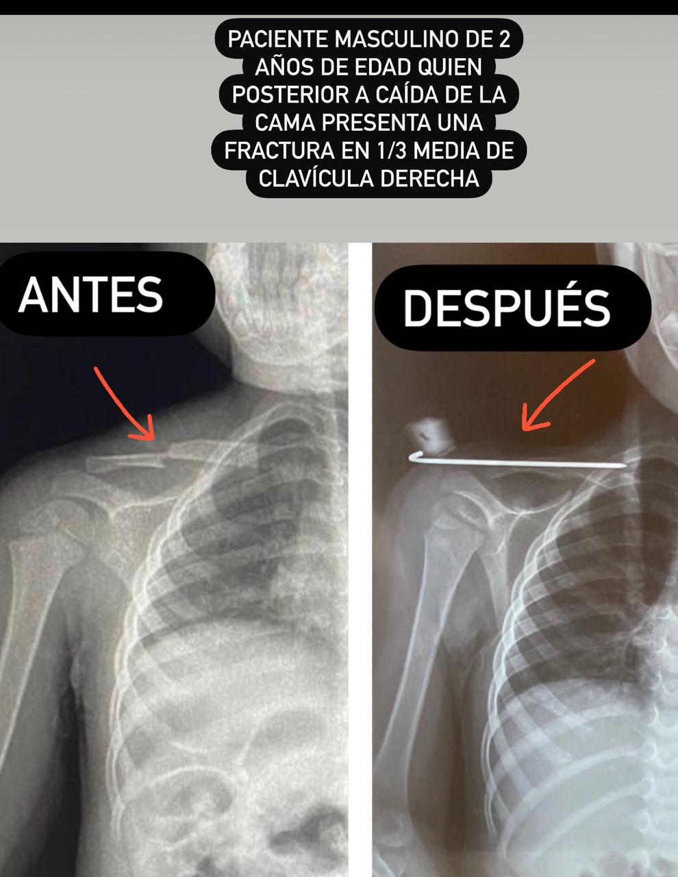 antes y depsues karina8 (1)