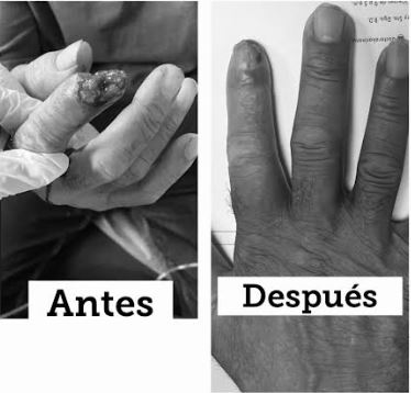 antes y despues karina1