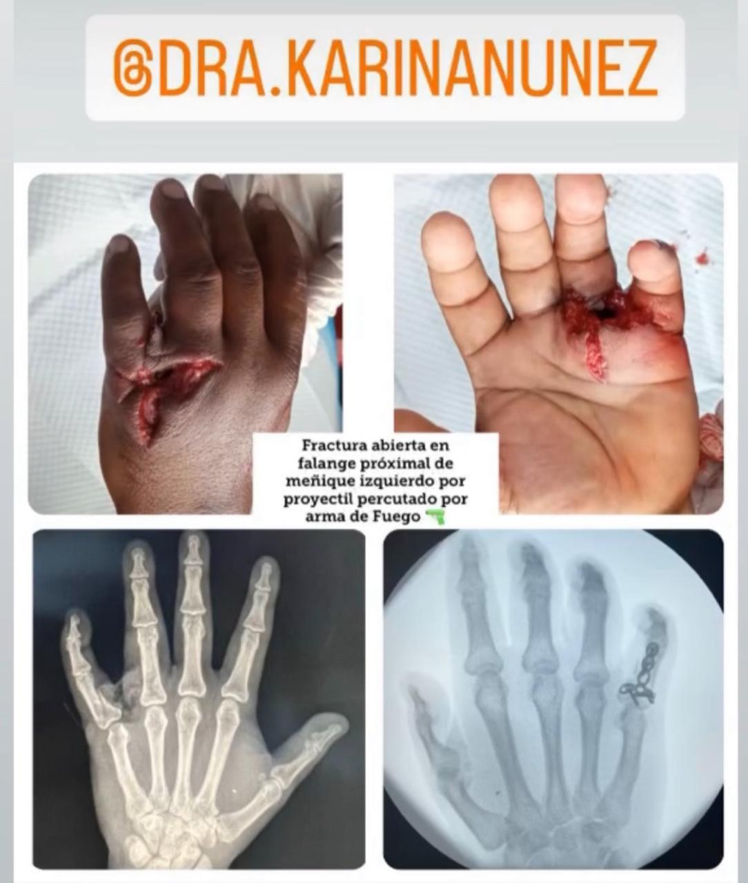 antes y despues karina4