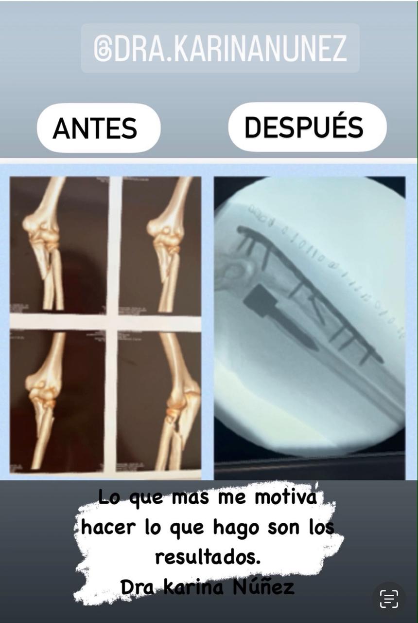 antes y despues karina5