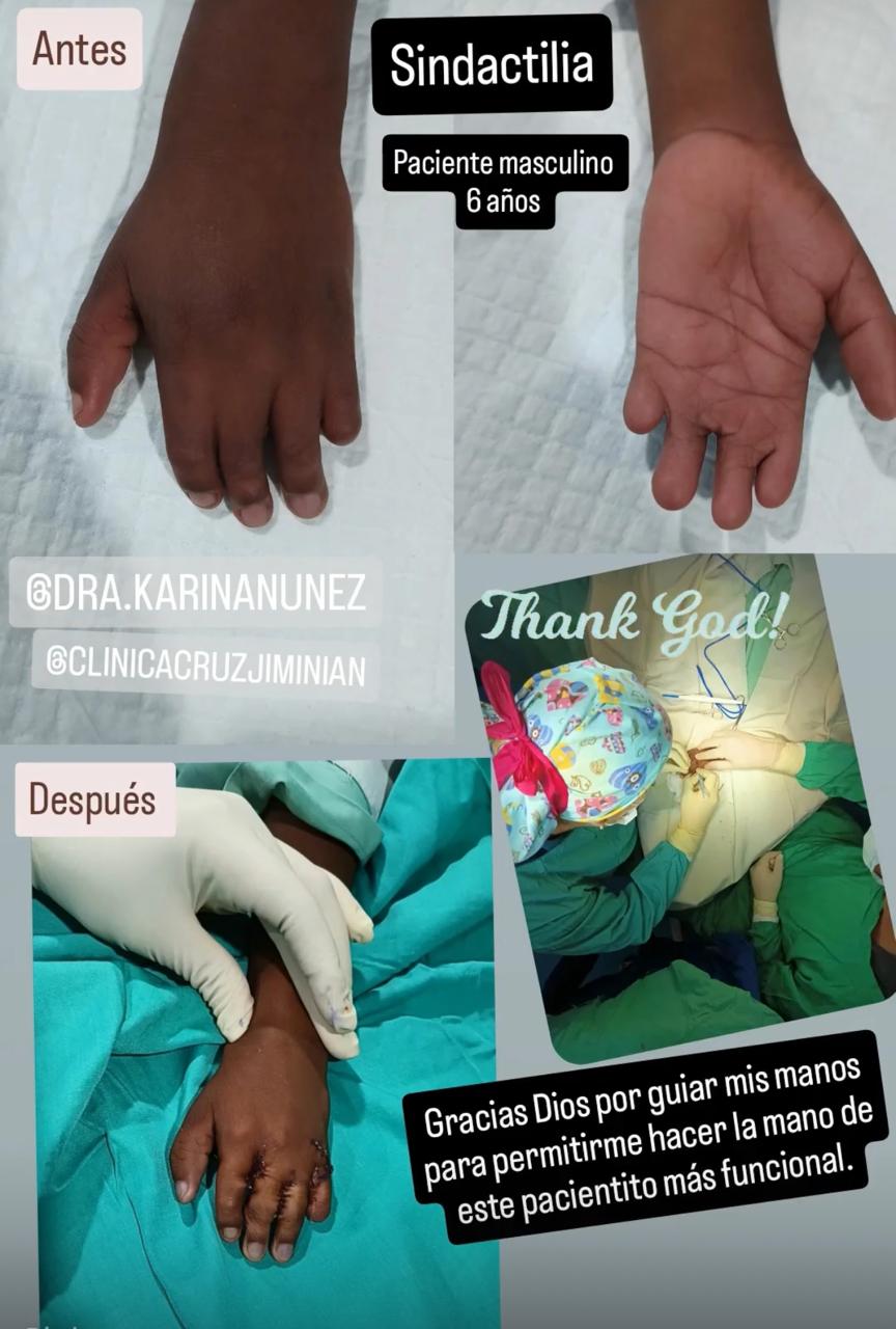 antes y despues karina6