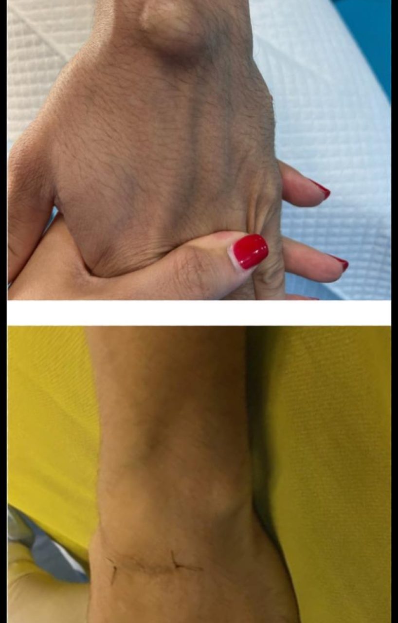 antes y despues karina9 (1)